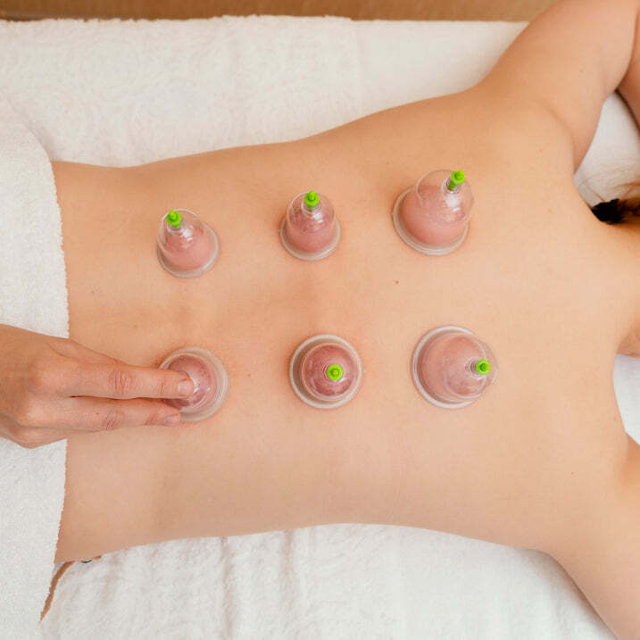 12PCS CUPS VACUUM CUPPING KIT