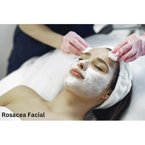Rosacea Facial Treatment Gentle On Skin at Best Price in Gandhinagar ...