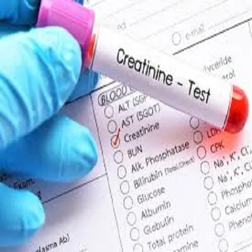 CREATININE 99 Percent