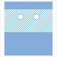 Pace Maker Drape - Medical-grade Sms Fabric, 4 Fenestrations, Blue | Fluid Containment, Absorbent Layer, Aseptic Folding Flexibility