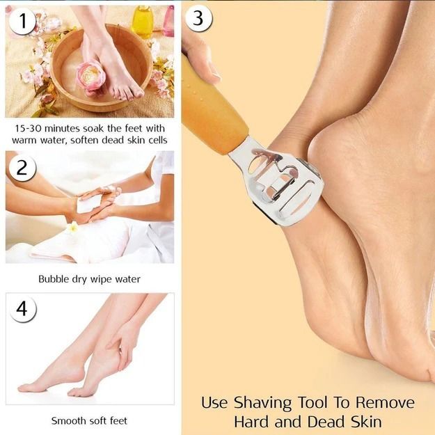 HARD SKIN REMOVER