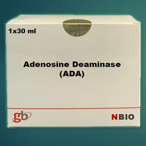 Adenosine Diminase Test Kit Grade: A