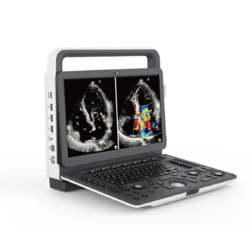M30 Portable Ultrasound Machine - Application: Hospital