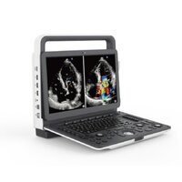 M30 Portable Ultrasound Machine - Application: Hospital