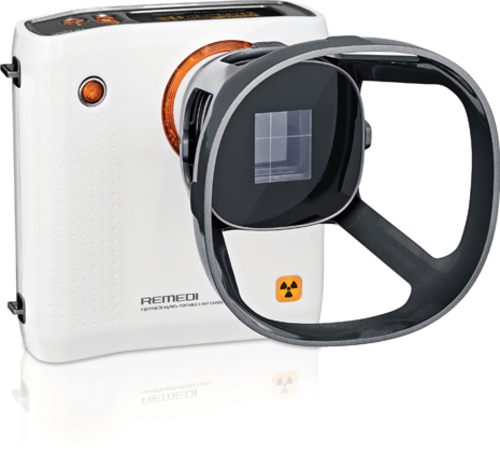 Digital Handheld X-Ray Camera