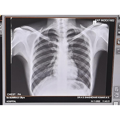 Human Body X-Ray Service By SBM HEALTH CARE