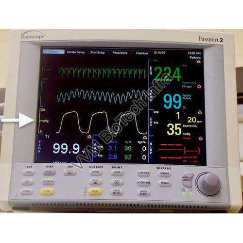 End Tidal Carbon Dioxide Monitor