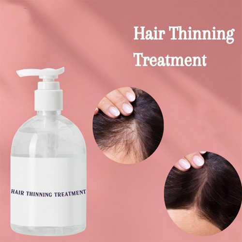 Hair Thinning Treatment