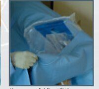 Arthroscopy Drape Eco E518