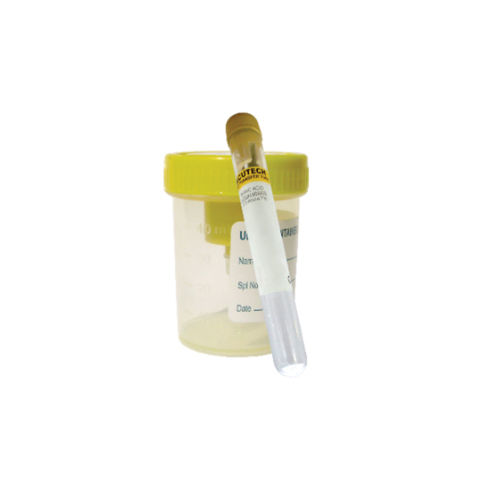 Transparent-yellow Vacuum Urine Transfer Plastic Container