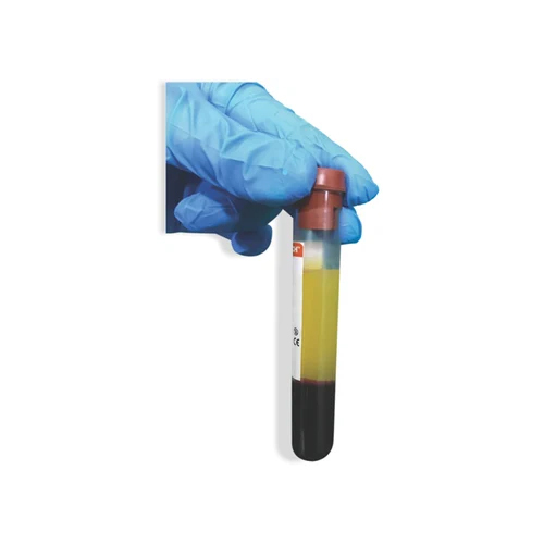 PRF Vacuum Blood Collection Tubes