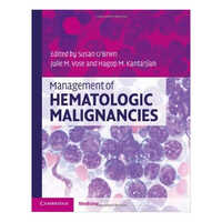 Management Of Hematologic Malignancies Book