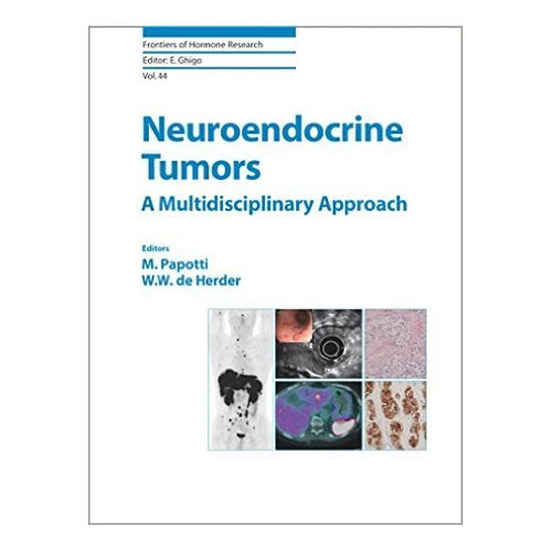 Neuroendocrine Tumors Book
