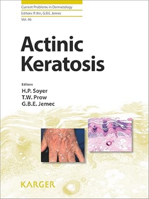 Actinic Keratosis Book