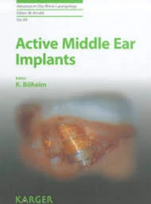 Active Middle Ear Implants Book