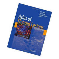 Atlas Of Thyroid Lesions Book
