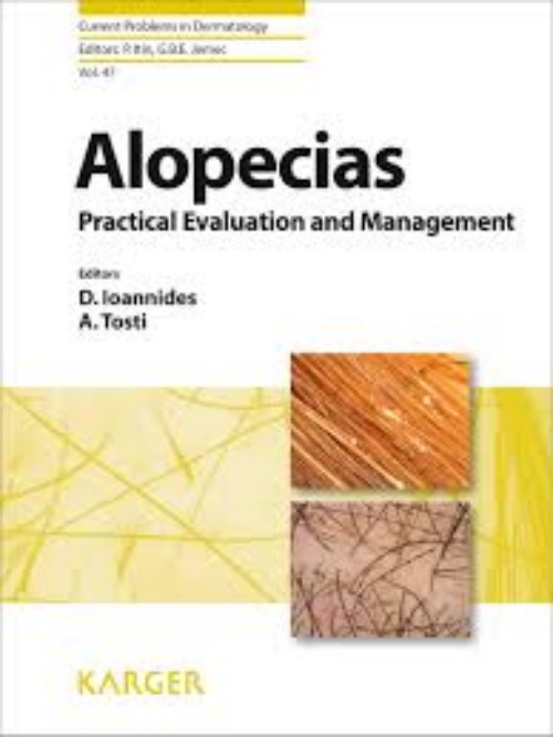 Alopecias - Practical Evaluation and Management Book
