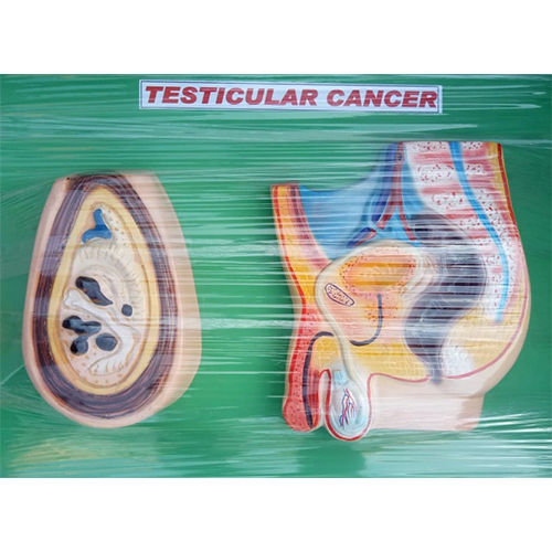 Testicular Cancer Male Pelvis Model