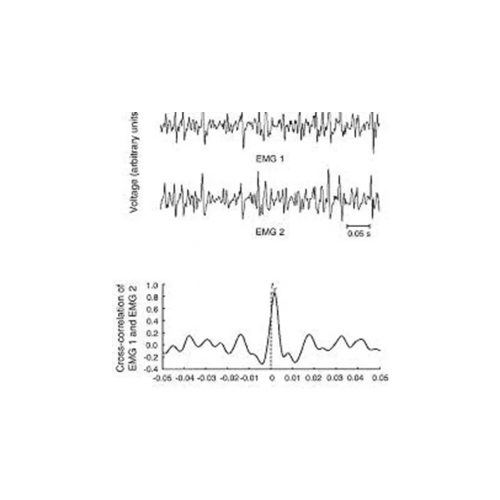 EMG Electromyography Machine