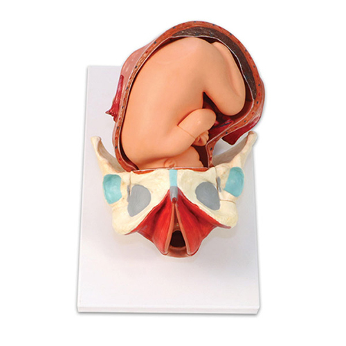 Baby Delivery Model