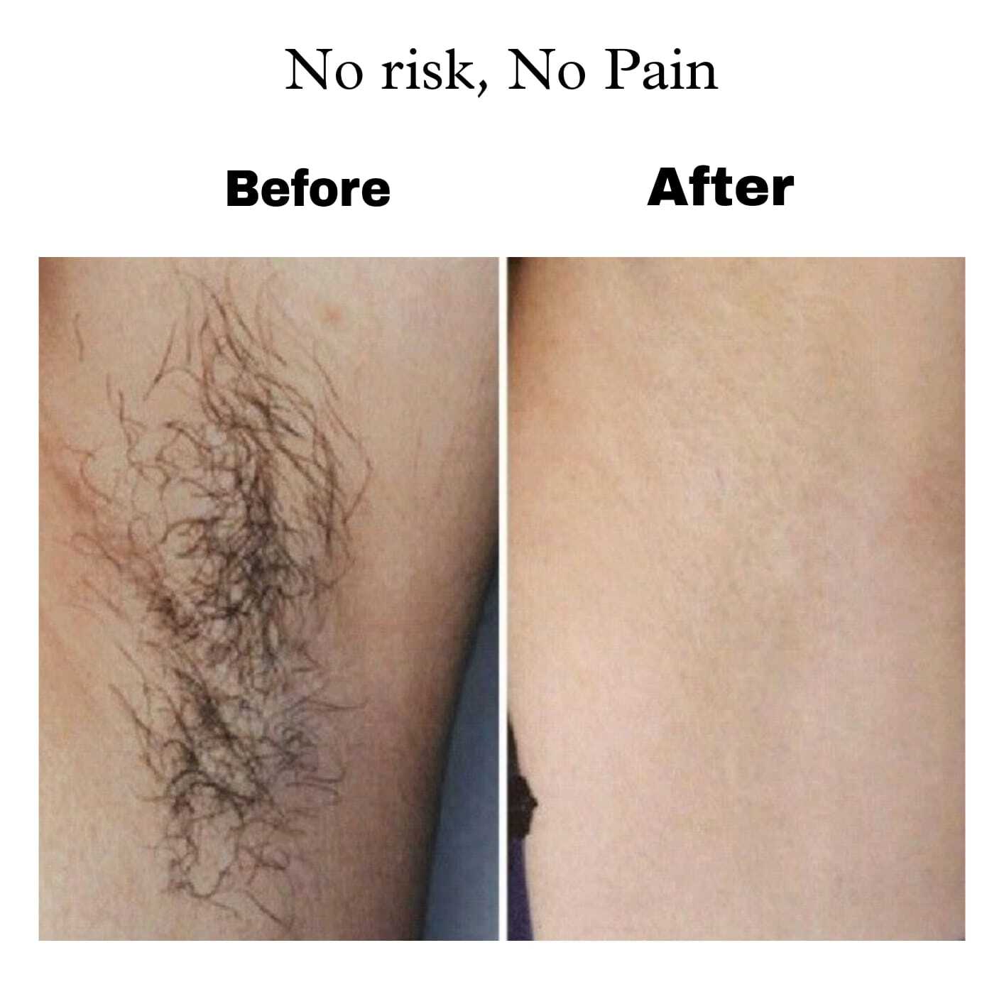 Natural Hair Removal Wax Powder