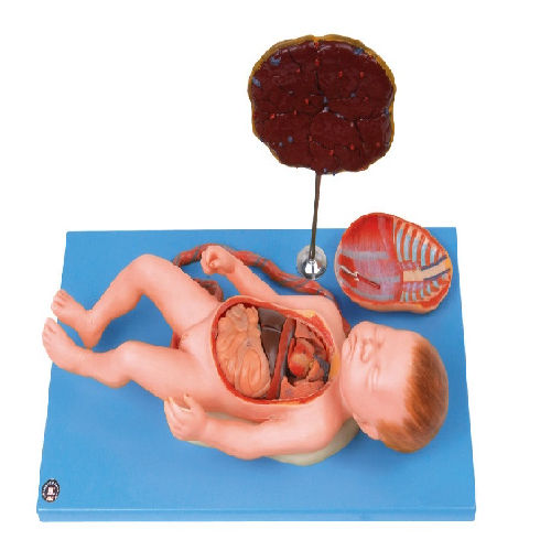 (GD/A42008) Fetus With Viscus And Placenta