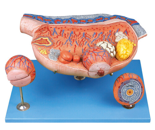 GD A41003 Ovary Model