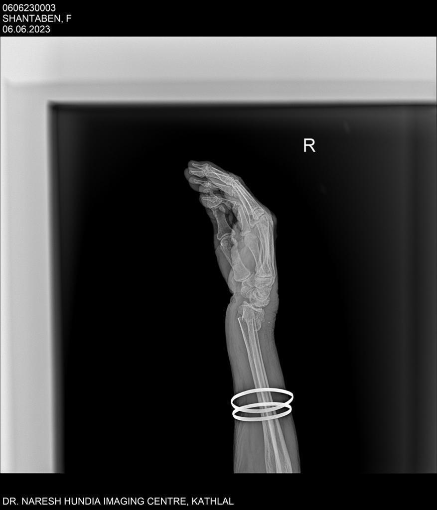 Digital Radiography machine