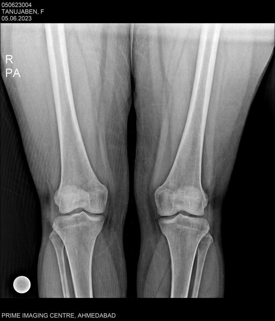 Digital Radiography machine