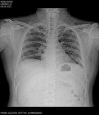 Digital Radiography machine