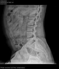 Digital Radiography machine