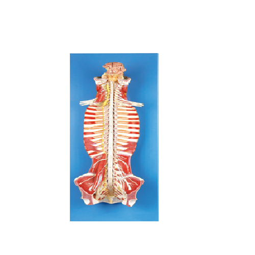 GD/A18102 Spinal Cord In The Spinal Canal