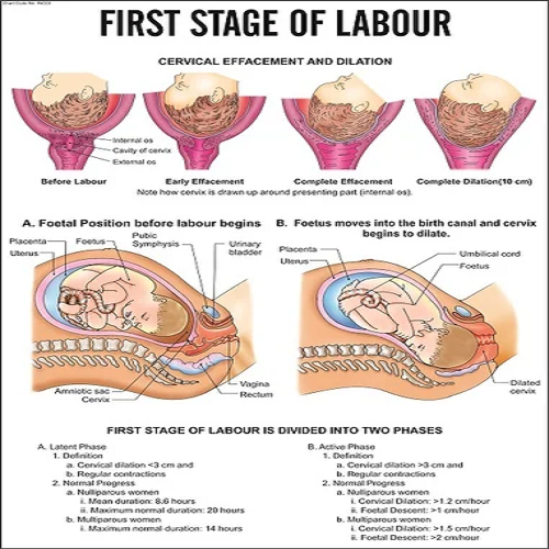 INC03 First Stage of labour