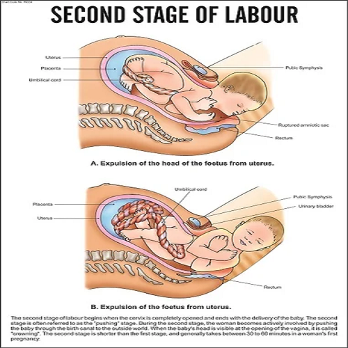 INC04 Second Stage of labour