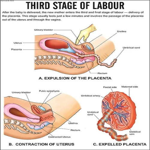 INC05 Third Stage of labour