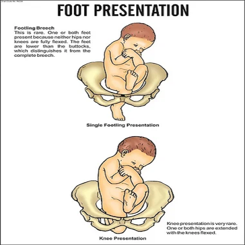 INC08 Foot Presentation