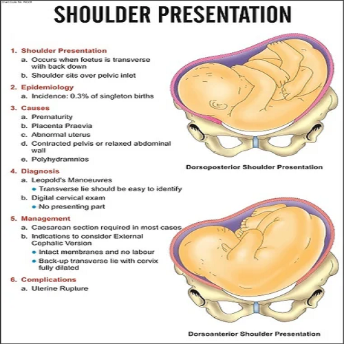 INC09 Shoulder Presentation