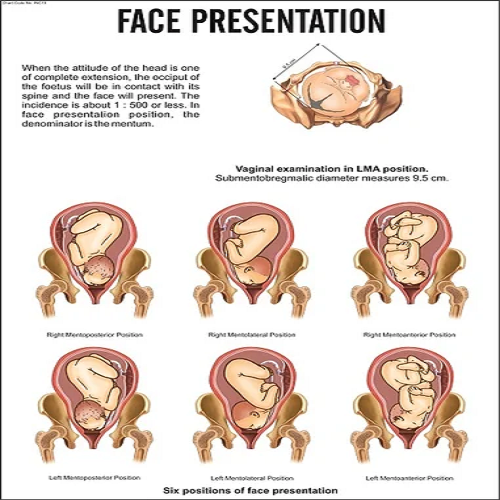 Nursing Charts