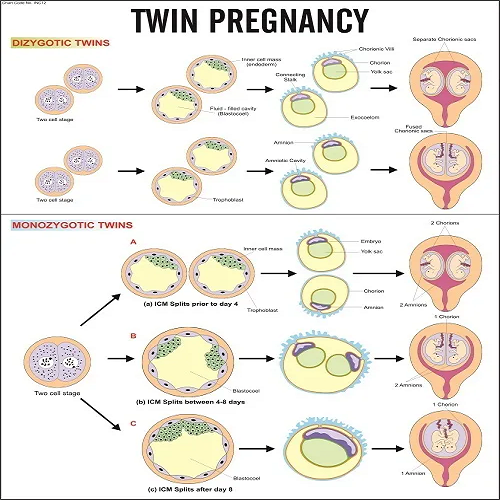 INC12  Twin Pregnancy