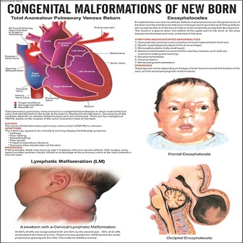 INC15  Congenital Malformation of New Born