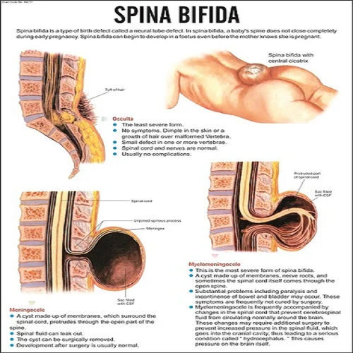 Nursing Charts