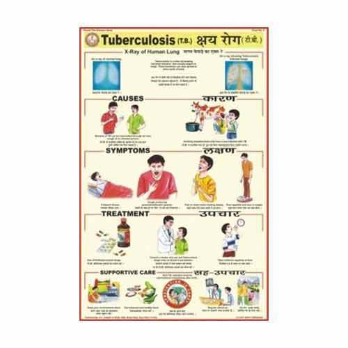 Pd05 Tuberculosis