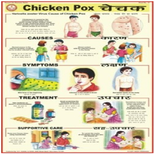 PD12 Chicken Pox