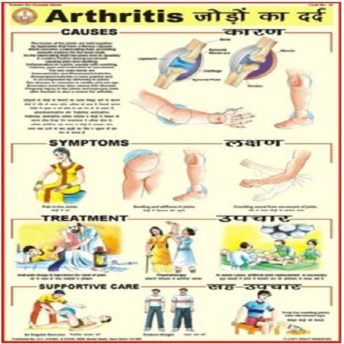 Prevent the diseases Charts