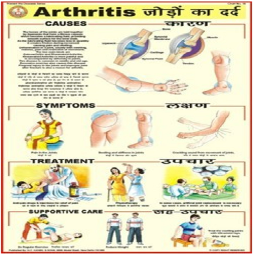 PD18 Arthritis