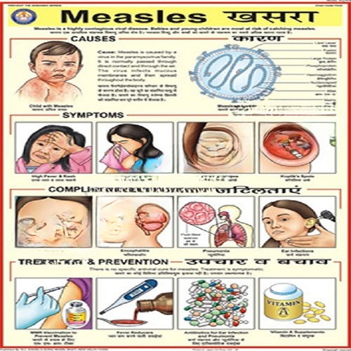 Pd22 Measles