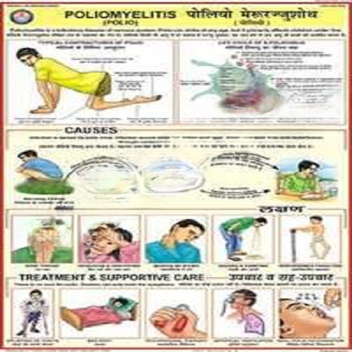 PD24 Poliomyelitis