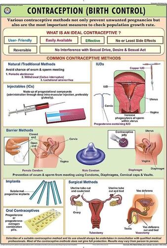 HP31S Contraception