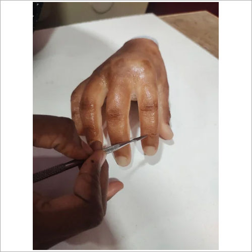 Plastic Genesis Silicone Prosthesis Partial Hand