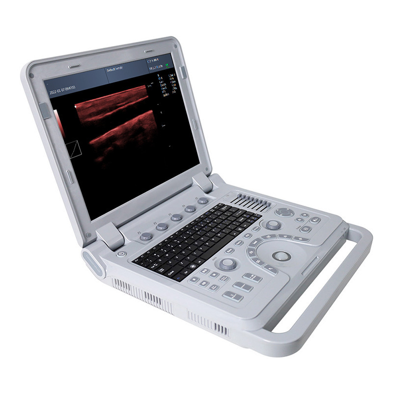 B-type ultrasonic diagnostic equipment for animal B-ultrasound machine Portable B-ultrasound detector